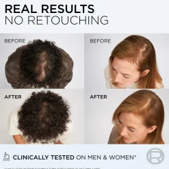 L'Oréal Paris Hårpleje><noscript><img width=